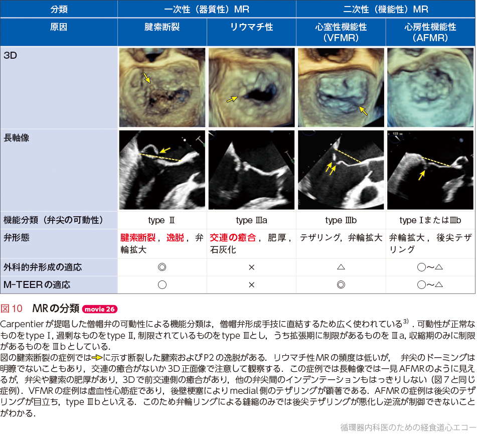 循環器内科医のための経食道心エコー〜基本的な手技から術中・術前の